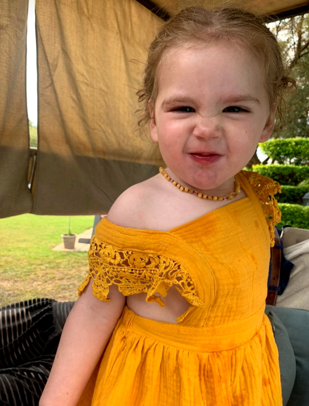 Yellow Lace Sleeved Dress